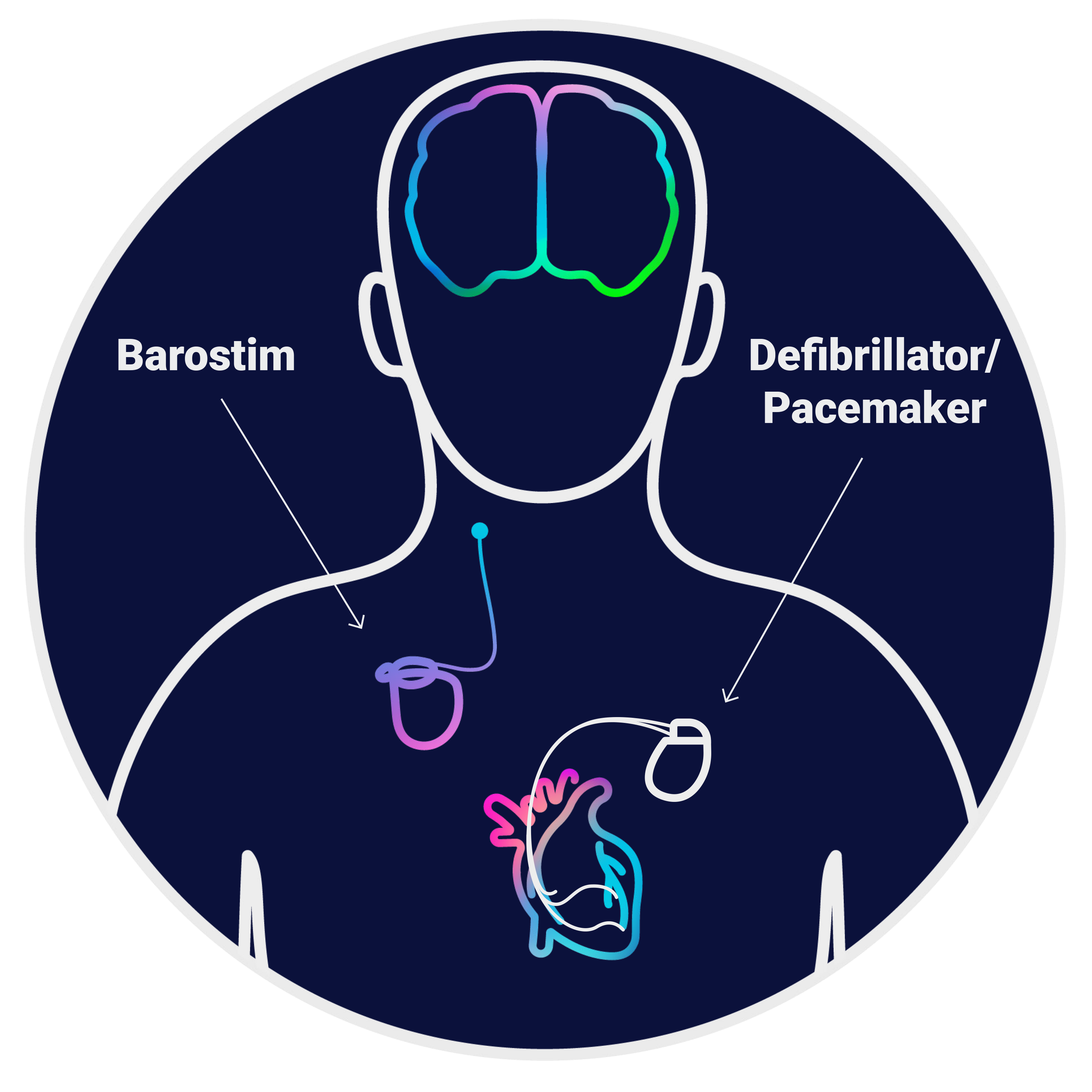 Barostim is not a defibrillator